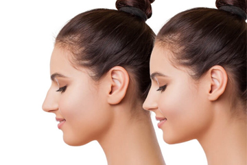 Rhinoplastie Tunisie